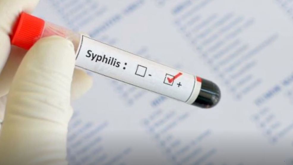 Chlamydia Test – A Simple, Quick Way to Find Out